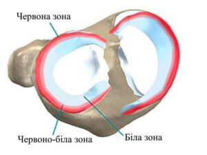 Лечение разрыва мениска в областной больнице Запорожья